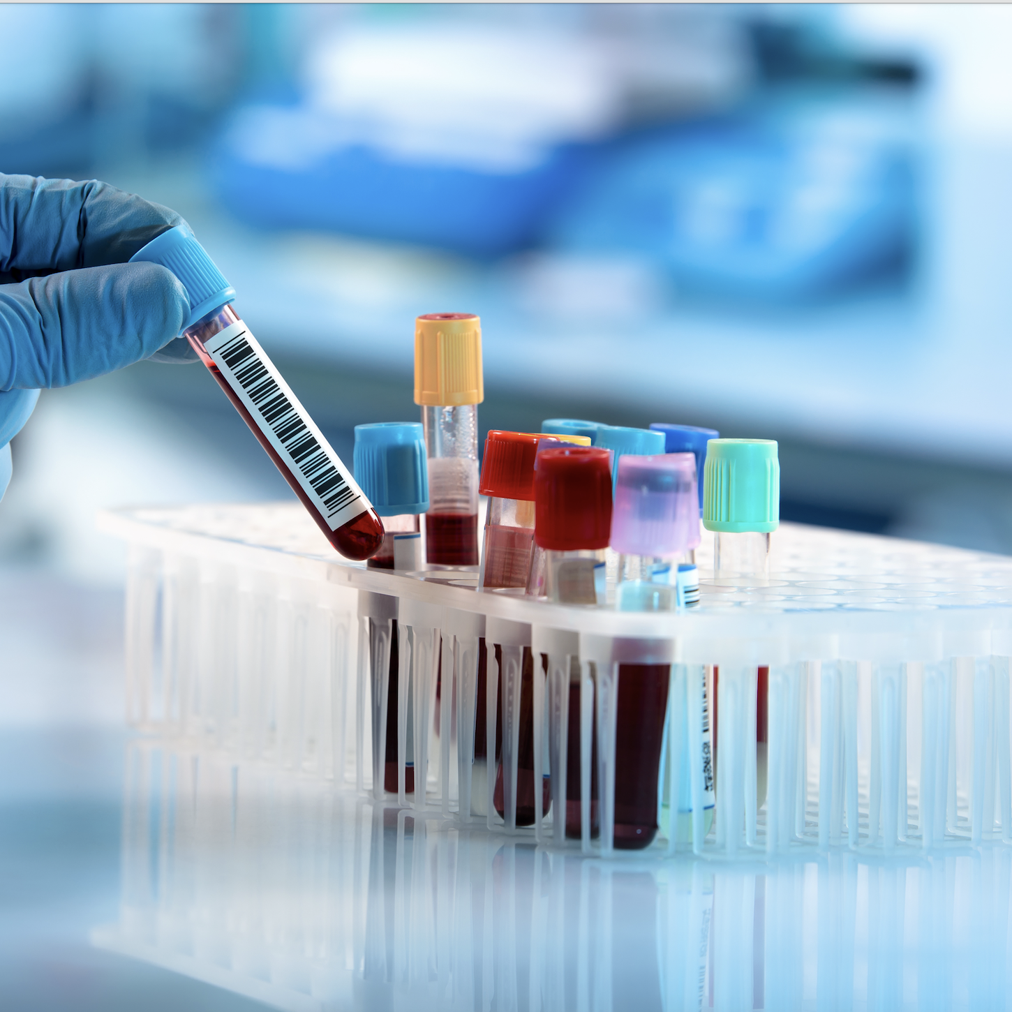 Blutröhrchen und Pipette im Labor